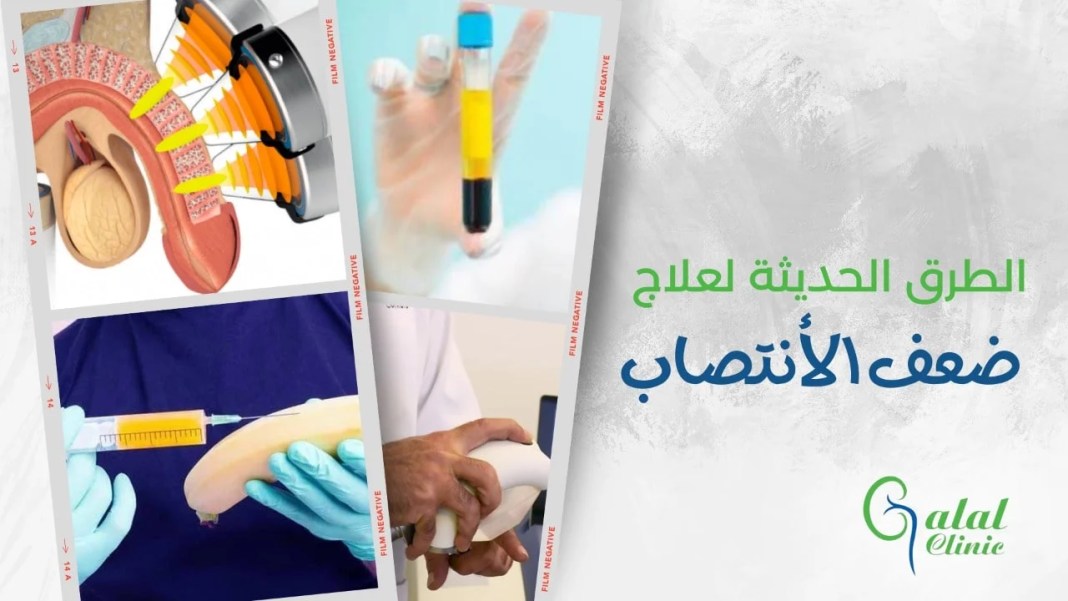 احدث طرق علاج ضعف الانتصاب الحديثة